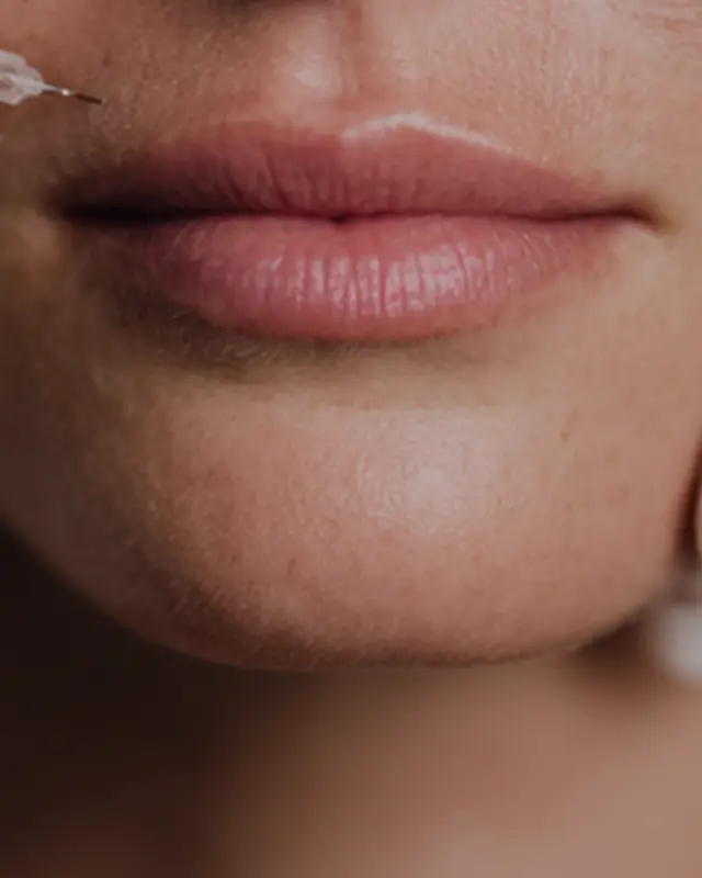 Dermal Fillers