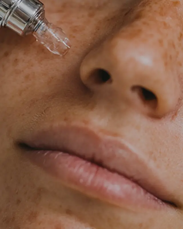 Microneedling